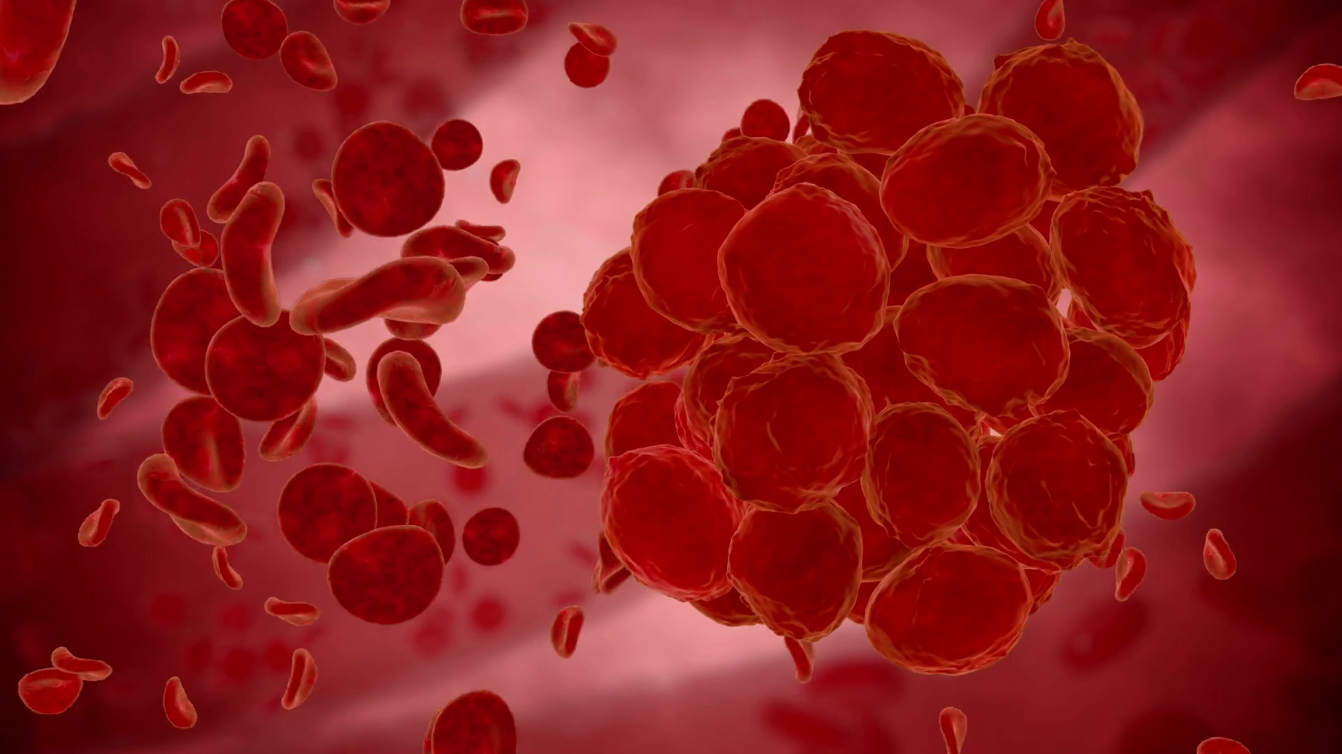 8 Signs You May Have A Blood Clot