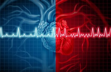 atrial fibrillation and a heart